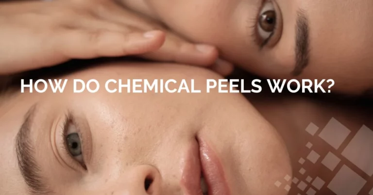 How Do Chemical Peels Work